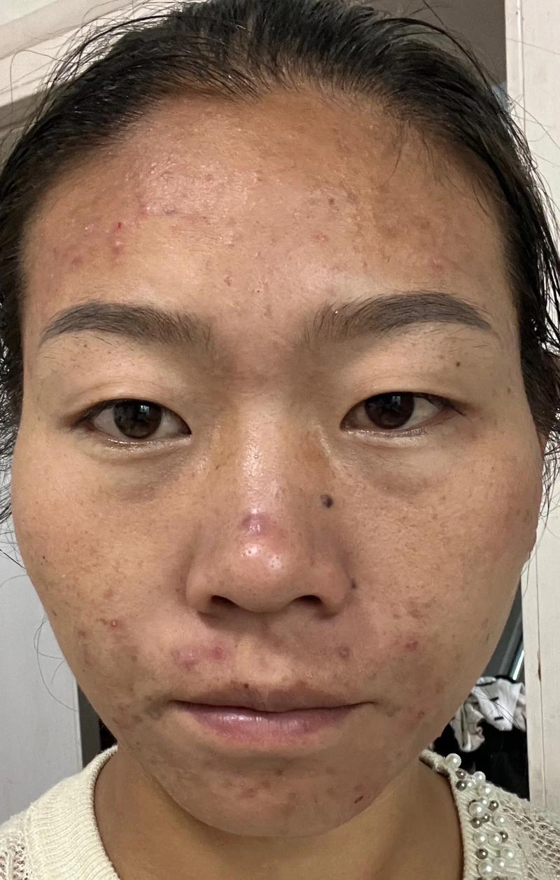 美体塑形新风尚，科技引领未来